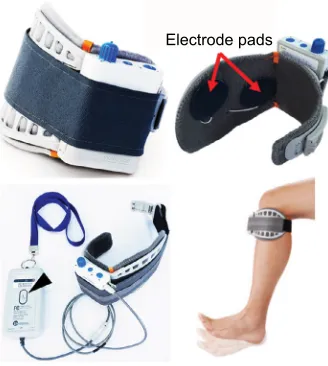 Figure 4 Commercial FES devices.Notes: (A) NESS L300 and wireless foot switch for gait and (B) NESS H200, which is worn over the paralyzed arm and hand