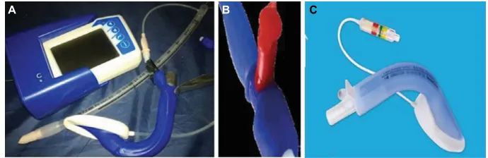 Figure 10 (Abbreviations:A) LMA CTrach. (B) Red Plug of PLMA. (C) Baska with integrated Cuff Pilot