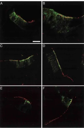 Figure 4.7: Overexpression of Deltal by RCAS virus in a sensory patch detected by HCA (red)