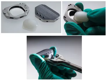 Figure 1 activL® Artificial Disc.