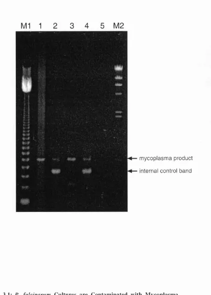 Figure 3.1: P. falciparumThe Mycoplasma PCR Primer Set was used to test control; this did not completely out-compete the mycoplasma-specific PCR, which results generated