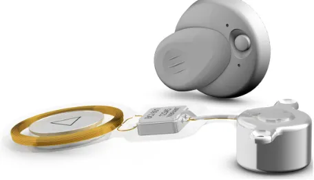 Figure 6 Bone-conduction implant, an active transcutaneous direct-drive bone-conduction device.