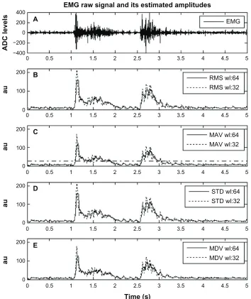Figure 4 Example of raw electromyograph (EMG) (A) along with the real-time measurement of muscle activity as provided by the root mean square (RMS) (B), mean absolute value (MAV) (C), standard deviation (STD) (D), and mean absolute differential value (MDV) (E) operators.Abbreviations: ADC, analog to digital converter; au, arbitrary units.