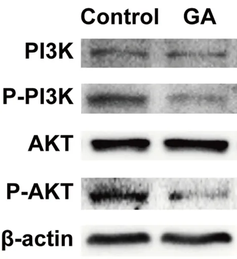 Figure 6 GA downregulates levels of the phosphorylated PI3K and AKT proteins.β-actin was used as a loading control