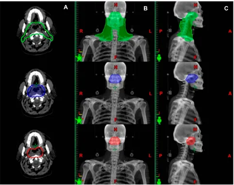 Figure 1 Examples of the contours of the planning target volumes (PTVs) in the axial (blue indicates PTVA), coronal (B), and sagittal (C) planes for a selected patient