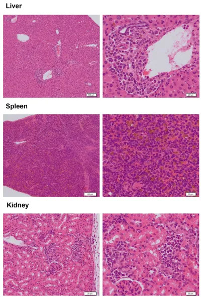 Figure 5 The Histopathological examination of abnormal mice. Spleen: The red pulp structure of the spleen almost disappears