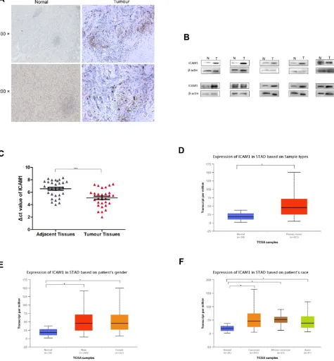 Figure 5 ICAM1 expression in GC patients. (A) Immunohistochemical localization of ICAM1 in GC