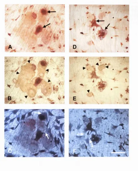 Figure 3.8 demonstrates the typical appearance of a disaggregated rat osteoclast assay 