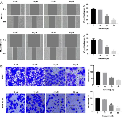 Figure 2 Curcumin inhibited the migration and invasion of breast cancer cells. (A) Wound healing rate of MCF-7 and MDA-MB-231 cells treated by different concentrationsof curcumin (0, 10, 20 and 30 μM) was detected by wound healing assay; (B) Invasion rate 