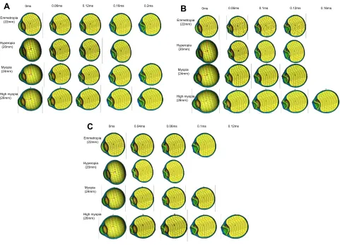 Figure 3 Ocular deformation after airsoft gun impact displayed sequentially in cross-sectional view at three impact velocities for four axial length eyes