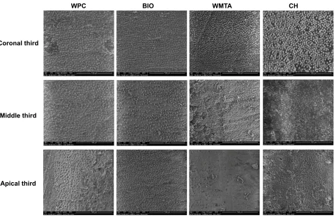 Table 8 Difference in Intercanal Medicaments Removal Betweenthe Different Groups Used in This Study Using SEM