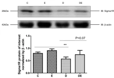 Figure 4 T2DM reduces sigma-1R protein expression. Western blots of Sigma-1R expression in gastrocnemius muscles from groups C, E, D and Group DE