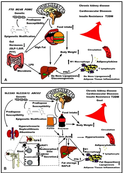 Figure 1 The comparison of pathophysiology of (Abbreviations:A) obesity and (B) hyperuricemia