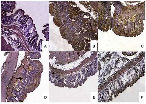 Figure 10 Microphotographs of rabbitin the lamina propria and submucosa (arrow) in rabbits pretreated with 10% w/w EC-coated tablets, and mild immunoreactivity limited to insubmucosa in rabbits pretreated with (Abbreviations:’s colon sections using immunoh