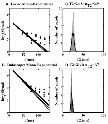 Figure 7 Mono-exponential ﬁtting lines (A, B) and distributions of T2 values (C, D) obtained using the torso coil (upper) and endoscope coil (lower) in ROI 1 of Specimen1.