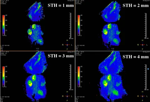 Figure 8 Coronal T2 maps of Specimen 1 obtained using the endoscope coil with different slice thicknesses between 1 mm and 4 mm.