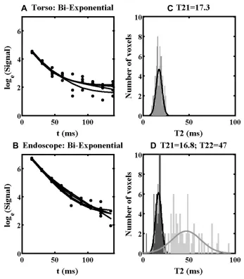 Figure 10 Bi-exponential ﬁtting lines (A, B) and distributions of T21 and T22 values (C, D) obtained using the torso coil (upper) and endoscope coil (lower) in ROI 1 ofSpecimen 1.