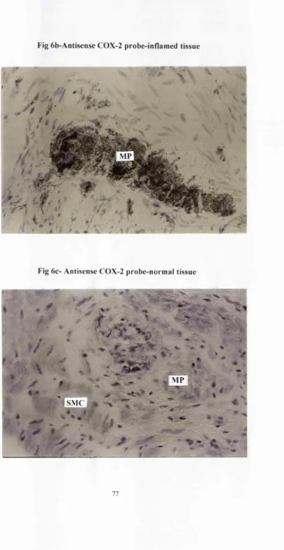 Fig 6b*Antisense COX-2 probe-inflamed tissue