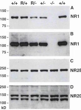 Figure 3-6 W estern blot analysis of membrane proteins from w hole brains from newbornThe membrane w as first analysed for NR2B before being stripped and reprobed with an antifor NR2B and ~ 150 kD for NR2D