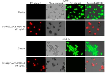 Figure 12 Mode of cell death as analyzed by ﬂuorescence microscopy (Biorevo, BZ-9000, Keyence) using EB and AO after the addition of active Fe3O4@OA-CS-5-FLU-NPin A549 and HeLa S3 cells