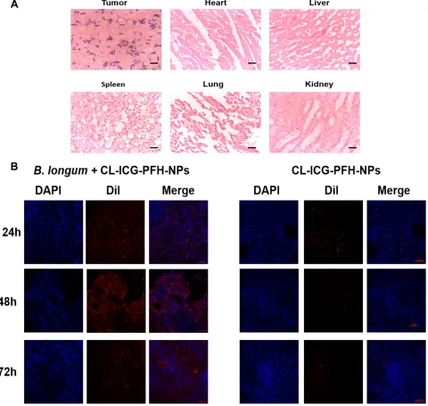 Figure 6 Targeting ability of the biological targeting synergist in vivo. (µm. (A) Gram staining for evaluating tumor targeting of B