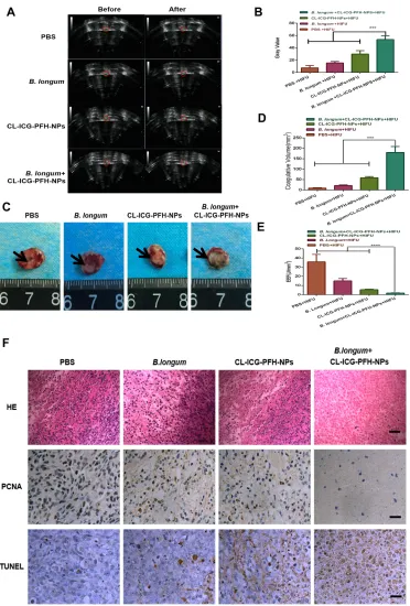 Figure 8of tumor sections from each group after HIFU ablation were stained for HE staining, PCNA and TUNEL assay