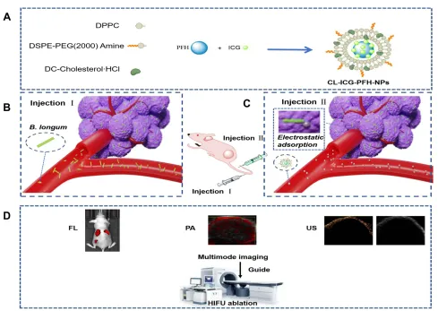 Figure 1 Schematic illustration of the biological targeting synergistic agent. (A) Synthetic procedures for CL-ICG-PFH-NPs