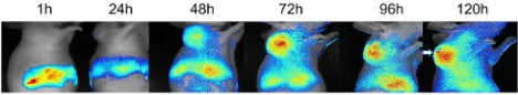 Figure 1 INIRF images. HeLa tumor bearing mice were systematically injected ofNIR-797 labeled Sal NPs, and observed for a period of 120h