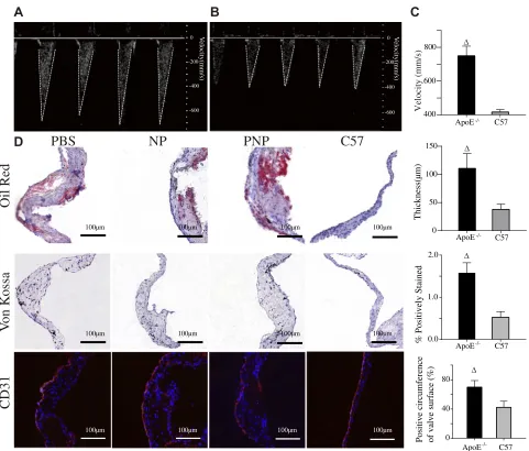 Figure 5 Proof of sclerosis. Representative Doppler images of ApoE−/− mice (A), C57 mice (B) and quantitative results of transaortic valve ﬂow velocity (C)