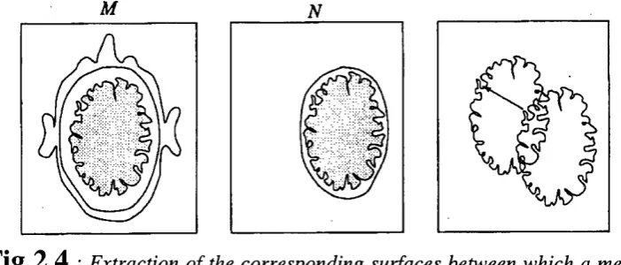 Fig 2.4 : Extraction of the corresponding surfaces between which a measure of mis­