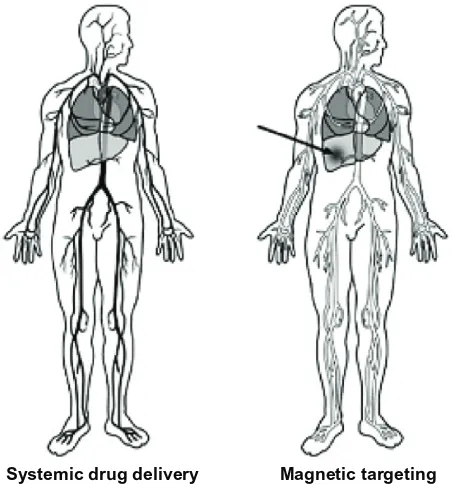 Figure 1 Concept of magnetic drug targeting.20