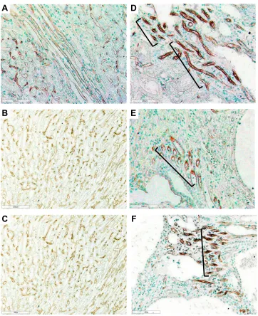 Figure 4 Photomicrographs of Lewis and LPK rats using RECA-1 immunostaining showing vascular bundles