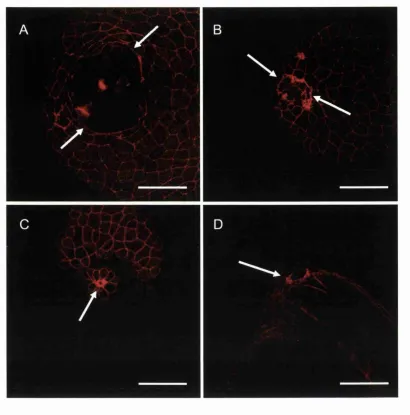 Figure 3.5 Actin-cable assembly in wound edge cells.