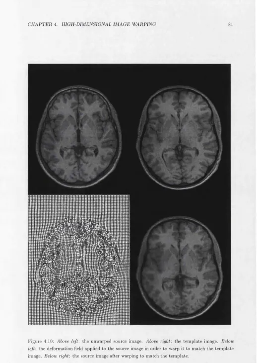 Figure 4.10; Above left: the unwarped source image. Above right: the template image. Below 