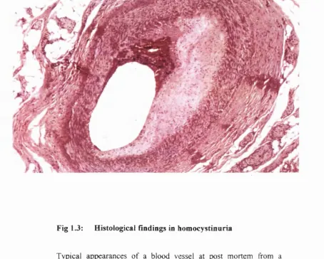Fig 1.3: 