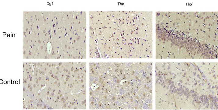 Figure 8 The expression of NMDAR in IHC. NMDAR expresses in the cytoplasm and nucleus of central nervous system tissues and overexpresses in apoptotic neuronsand partial Nissl body