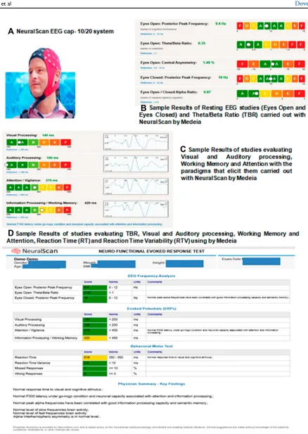 Figure 1 EEG-based frequency analysis using (A) NeuralScan by Medeia showing demo results of: (B) Resting EEG (Eyes Open and Eyes Closed) and Theta/Beta ratio, (C)Visual and Auditory processing, Working Memory and Attention and (D) Theta/Beta ratio, Visual and Auditory processing, Working Memory, Attention Reaction Time (RT)and Reaction Time Variability (RTV).