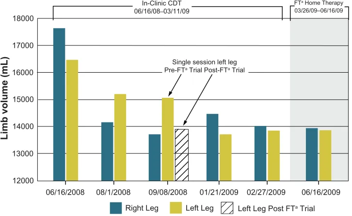 Figure 1 case report 1: bilateral leg volume changes.Note: aFT,flexitouch. 