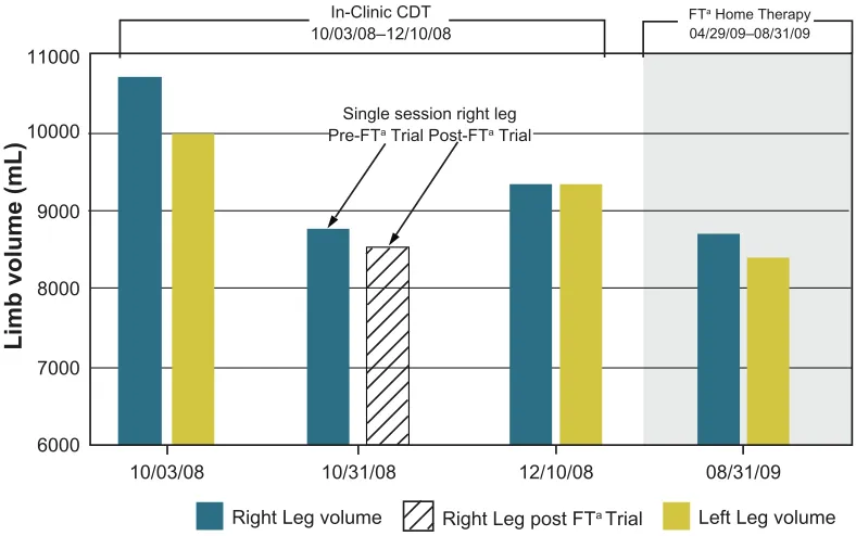 Figure 2 case report 2: bilateral leg volume changes.Note: aFT,flexitouch. 