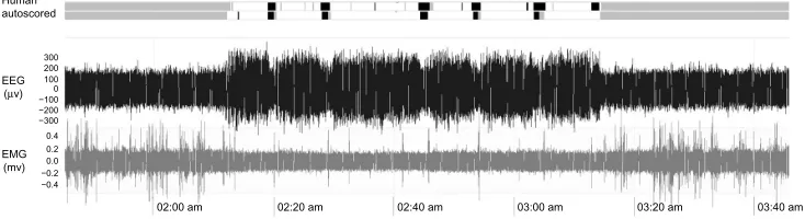 Figure 2 EEG and EMG data for comparison of human scoring and machine scoring.Notes: The top two traces show human and autoscored sleep states for each 10-second epoch of the EEG and EMG shown in the lower panels