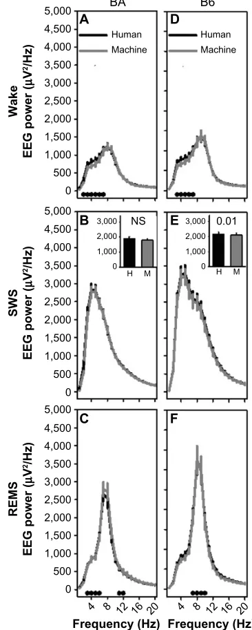 Figure 6 Machine-scored data in 10-second epochs exhibit similar frequency profiles to human-scored data.Notes: The left column shows data for the BA strain and the right column shows data for the B6 strain