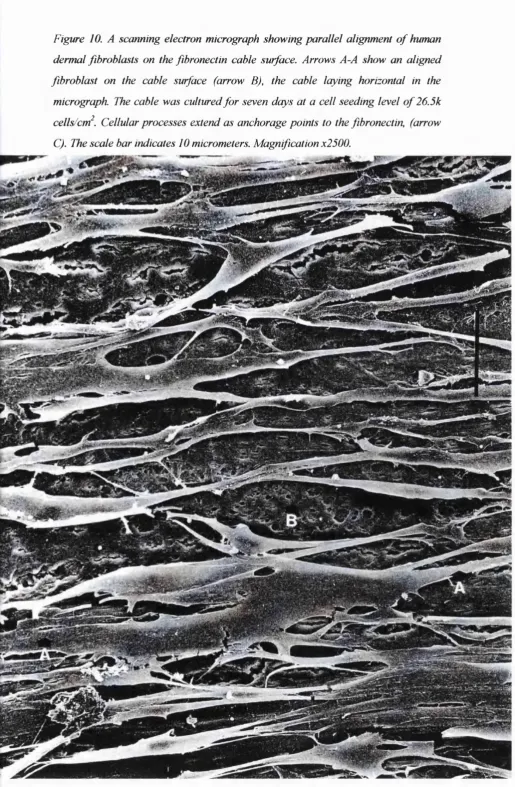 Figure 10. A scanning electron micrograph showing parallel alignment of human 