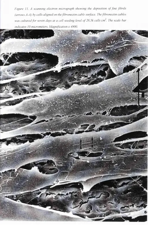 Figure 11. A scanning electron micrograph showing the deposition o f fine fibrils 