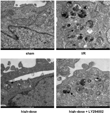 Figure 4 TEM images showing the ultrastructural changes. The ultrastructural changes among sham, I/R, high-dose deltonin, and high-dose deltonin+LY294002 showed thatdeltonin reduced autophagy activities during cerebral I/R injury.