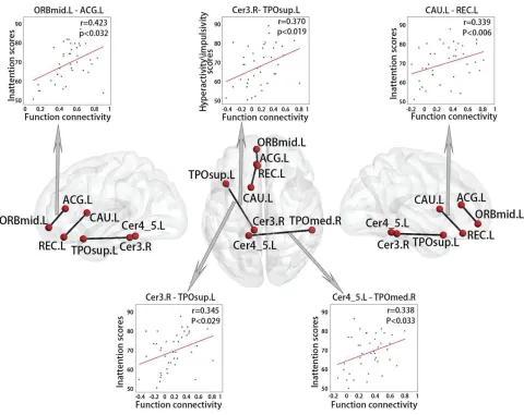 Figure 6 Correlations between behavioural variables and functional connections in ADHD.Abbreviations: L, left hemisphere; R, right hemisphere; CAU, caudate; ACG, anterior cingulate gyrus; TPOsup, temporal pole (superior); TPOmed, temporal pole (medial);REC, rectus; ORBmid, orbitofrontal cortex (middle); Cer, cerebellum.