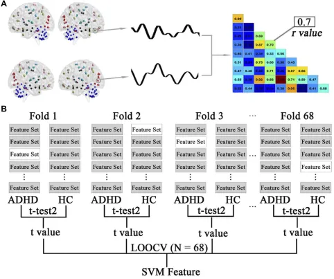 Figure 1 Schematic diagram of feature extraction and selection. (A) The average time series of all voxels within the automated anatomical labelling (AAL) regions were usedto generate a representative time course