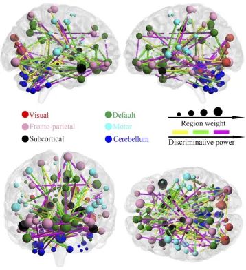 Figure 4 The distribution of consensus discriminative functional connections and their related regional weights