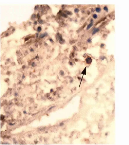 Figure 5.2a. Example of DAB single positive cell and 