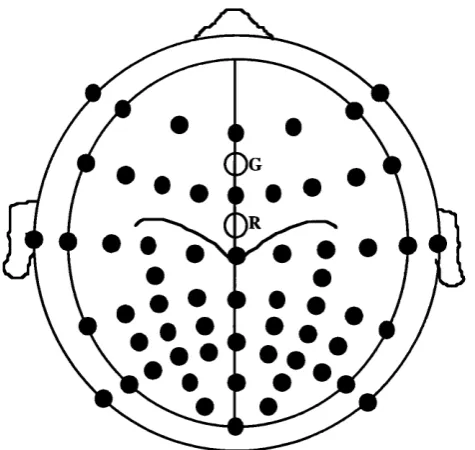 Figure 4.1: Montage used for vSEPs and eSEPs. R=reference electrode and G=ground electrode.