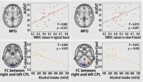 Figure 6 Correlations between functional results (VMHC and FC) and clinical variables (AUDIT score and alcohol intake) in individuals with AD.Abbreviations: CPL, cerebellum posterior Lobe; MFG, middle frontal gyrus; FC, functional connectivity; AUDIT, alcohol use disorders identiﬁcation test; VMHC, voxel-mirrored homotopic connectivity; AD, alcohol dependence.